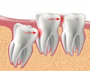 What Is Maxillofacial Surgery?