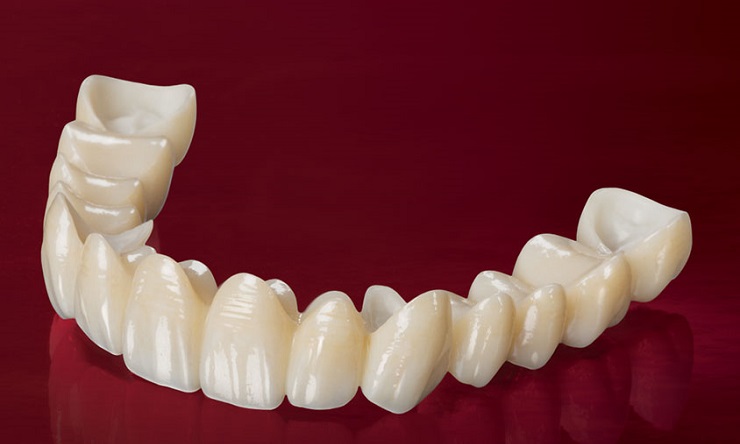 Zirconia Crown